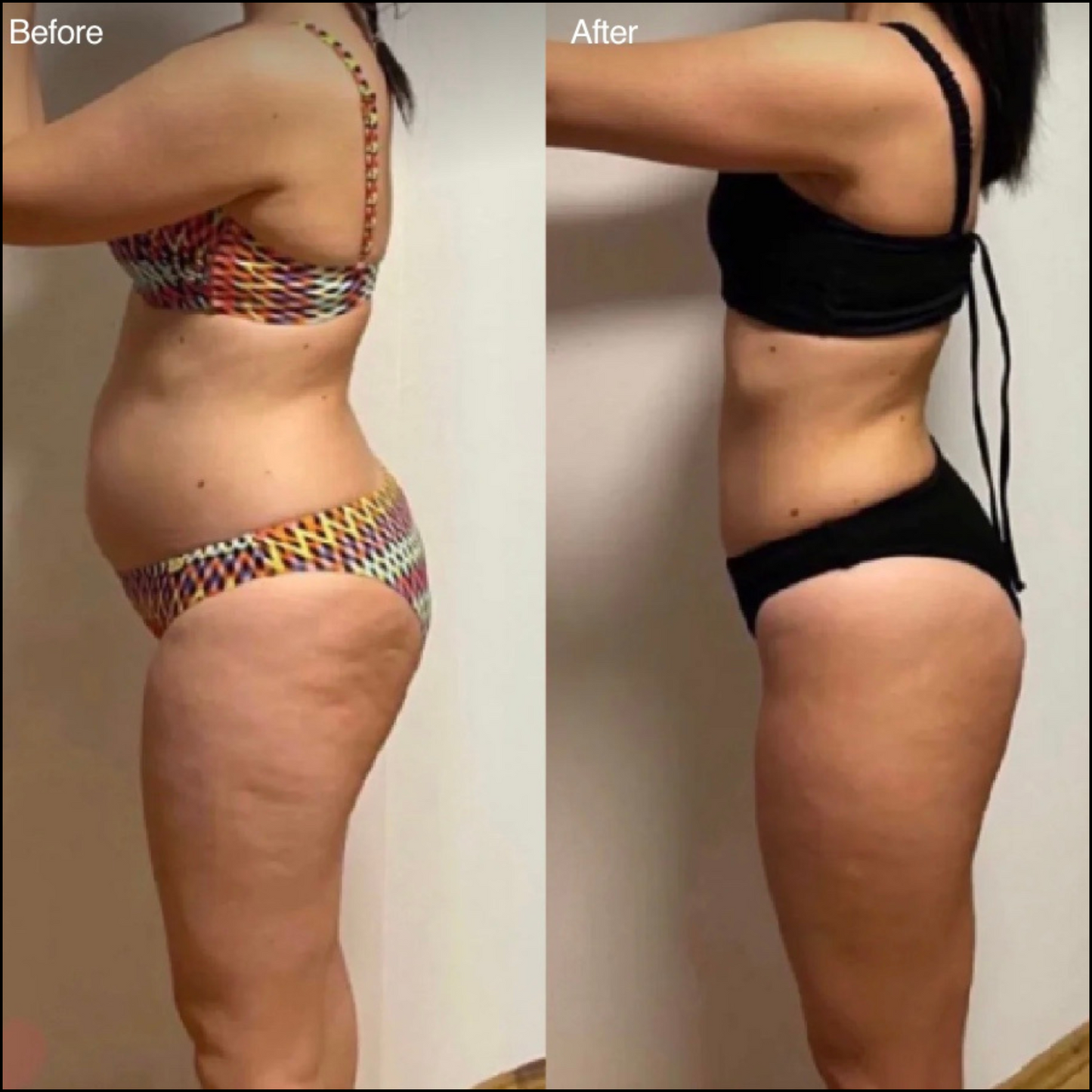 SheCurves™ BodySculpt