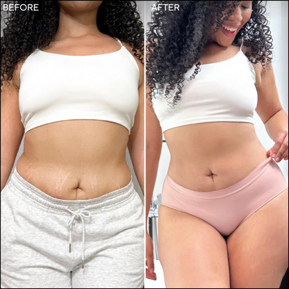 SheCurves™ BodySculpt